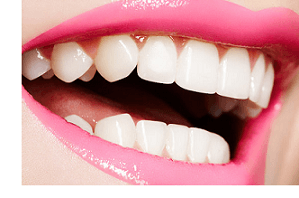 Teeth Whitening for the perfect smile