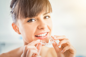 Invisalign - clear aligners - clear braces
