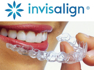 Invisalign clear aligners for straight teeth