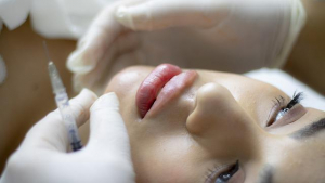 Facial aesthetics in Harrow: Lip fillers